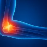 Aplicativos de Dores Articulares com Alertas Diários