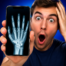 Aplicativos para Simular Raio X no Celular Grátis